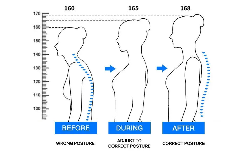 Aurisle Adjustable Posture Corrector
